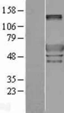 Novus Biologicals&trade;&nbsp;Peripherin Overexpression Lysate