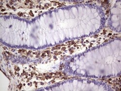 Peripherin Antibody (OTI1E10), Novus Biologicals 0.1mL; Unlabeled:Antibodies,
