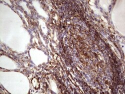 Peripherin Antibody (OTI1E10), Novus Biologicals 0.1mL; Unlabeled:Antibodies,