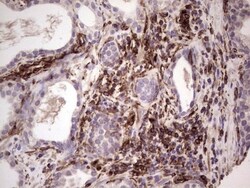 Peripherin Antibody (OTI1E10), Novus Biologicals 0.1mL; Unlabeled:Antibodies,