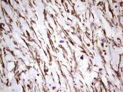 Peripherin Antibody (OTI1E10), Novus Biologicals 0.1mL; Unlabeled:Antibodies,