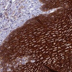 Periplakin Antibody, Novus Biologicals:Antibodies:Primary Antibodies
