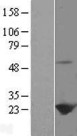 Novus Biologicals&trade;&nbsp;Peroxiredoxin 1 Overexpression Lysate