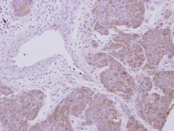 Peroxiredoxin 2 Antibody, Novus Biologicals 0.1mL; Unlabeled:Antibodies,