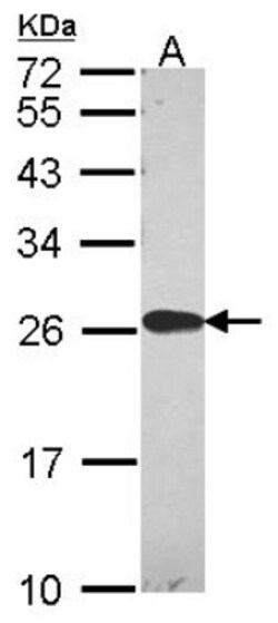 Peroxiredoxin 2 Antibody, Novus Biologicals 0.1mL; Unlabeled:Antibodies,