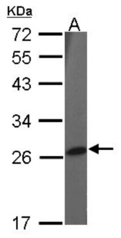 Peroxiredoxin 2 Antibody, Novus Biologicals 0.1mL; Unlabeled:Antibodies,