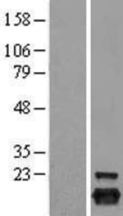 Novus Biologicals&trade;&nbsp;Peroxiredoxin 5 Overexpression Lysate