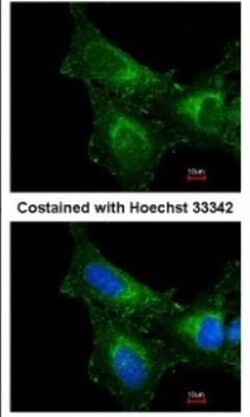 Peroxiredoxin 1 Antibody, Novus Biologicals 0.1mL; Unlabeled:Antibodies,