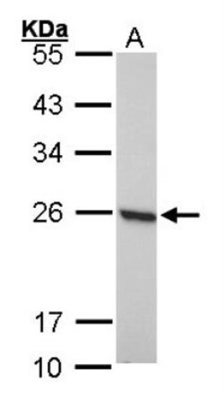 Peroxiredoxin 1 Antibody, Novus Biologicals 0.1mL; Unlabeled:Antibodies,