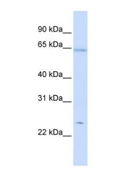 Peroxiredoxin 2 Antibody, Novus Biologicals 0.05mg; Unlabeled:Antibodies,