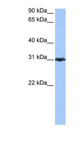 Peroxiredoxin 3 Antibody, Novus Biologicals 100&mu;L; Unlabeled:Antibodies,