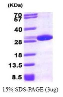 Novus Biologicals&trade;&nbsp;Recombinant Human Peroxiredoxin 6 His Protein