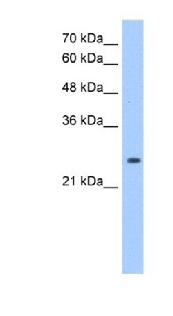 Peroxiredoxin 6 Antibody, Novus Biologicals 0.1mg; Unlabeled:Antibodies,