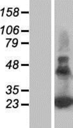 Novus Biologicals&trade;&nbsp;PERP Overexpression Lysate