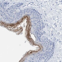 PERP Antibody, Novus Biologicals 25ul | Buy Online | Novus Biologicals | Fisher Scientific