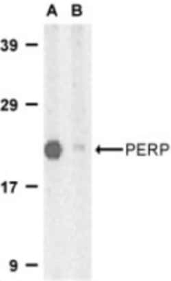 PERP Antibody - BSA Free, Novus Biologicals 0.1 mg | Buy Online | Novus Biologicals | Fisher Scientific