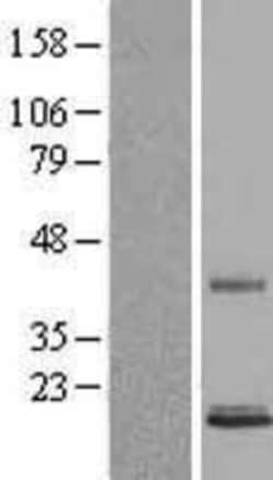 Novus Biologicals&trade;&nbsp;Persephin Overexpression Lysate
