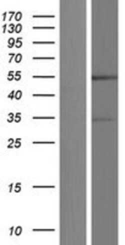 Novus Biologicals&trade;&nbsp;GFR alpha-4/GDNF R alpha-4/Persephin receptor Overexpression Lysate