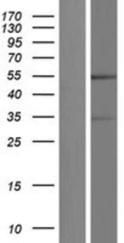 Novus Biologicals&trade;&nbsp;GFR alpha-4/GDNF R alpha-4/Persephin receptor Overexpression Lysate