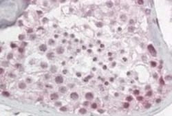 Pescadillo Antibody, Novus Biologicals 0.1 mg | Buy Online | Novus Biologicals | Fisher Scientific