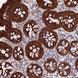 PET112L Antibody, Novus Biologicals:Antibodies:Primary Antibodies