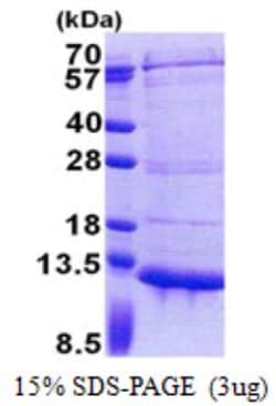 Novus Biologicals&trade;&nbsp;Recombinant Human PET117 His Protein