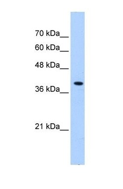 PEX10 Antibody, Novus Biologicals 0.05mg; Unlabeled:Antibodies, Polyclonal