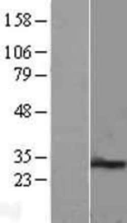 Novus Biologicals&trade;&nbsp;PEX11B Overexpression Lysate