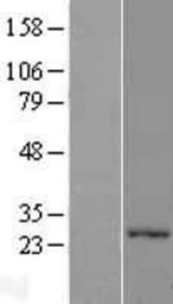 Novus Biologicals&trade;&nbsp;PEX11G Overexpression Lysate
