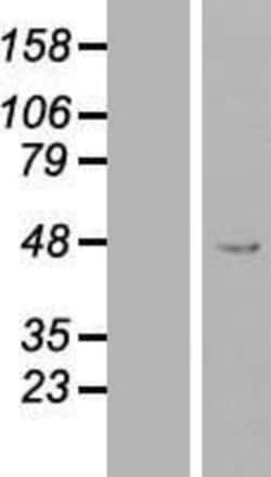 Novus Biologicals&trade;&nbsp;PEX13 Overexpression Lysate
