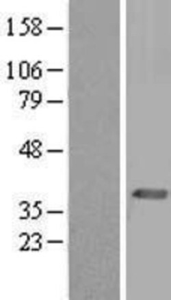 Novus Biologicals&trade;&nbsp;PEX19 Overexpression Lysate