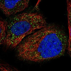 PEX1 Antibody, Novus Biologicals 25ul | Buy Online | Novus Biologicals | Fisher Scientific