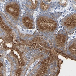 PEX1 Antibody, Novus Biologicals 25ul | Buy Online | Novus Biologicals | Fisher Scientific