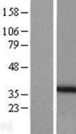 Novus Biologicals&trade;&nbsp;PEX26 Overexpression Lysate