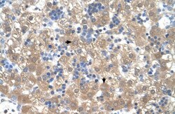 PEX3 Antibody, Novus Biologicals 0.1mg; Unlabeled:Antibodies, Polyclonal