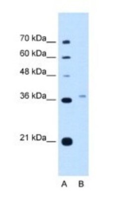 PEX3 Antibody, Novus Biologicals 0.1mg; Unlabeled:Antibodies, Polyclonal