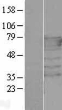 Novus Biologicals™ PEX5 Overexpression Lysate