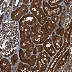 PEX5 Antibody, Novus Biologicals 25 &mu;L; Unlabeled:Antibodies, Polyclonal