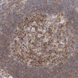 PEX6 Antibody, Novus Biologicals:Antibodies:Primary Antibodies