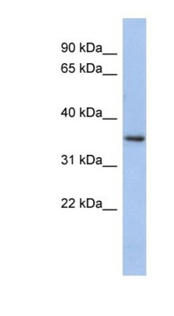 PEX7 Antibody, Novus Biologicals 100&mu;L; Unlabeled:Antibodies, Polyclonal