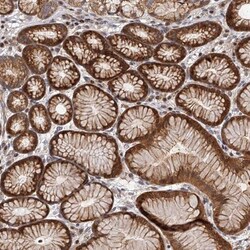 PFDN2 Antibody, Novus Biologicals:Antibodies:Primary Antibodies