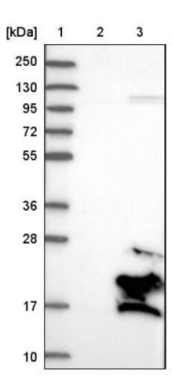 PFDN2 Antibody, Novus Biologicals 0.1mL; Unlabeled:Antibodies, Polyclonal