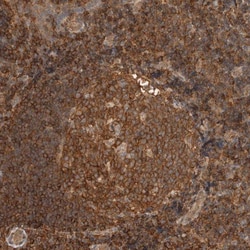 PFDN4 Antibody, Novus Biologicals 0.1mL; Unlabeled:Antibodies, Polyclonal
