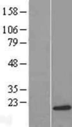 Novus Biologicals&trade;&nbsp;PFDN5 Overexpression Lysate