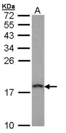 PFDN5 Antibody, Novus Biologicals 0.1mL; Unlabeled:Antibodies, Polyclonal