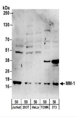 PFDN5 Antibody, Novus Biologicals 0.1mg; Unlabeled:Antibodies, Polyclonal