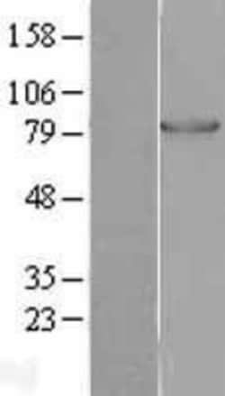 Novus Biologicals™ Muscle Phosphofructokinase/PFKM/PFK-1 Overexpression Lysate