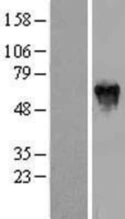 Novus Biologicals&trade;&nbsp;PFKFB2 Overexpression Lysate
