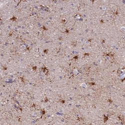 PFKFB2 Antibody, Novus Biologicals 25 &mu;L, Unlabeled:Antibodies, Polyclonal