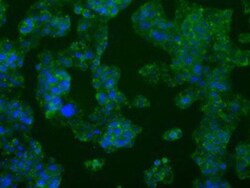 PFKFB4 Antibody (OTI1C8), Novus Biologicals 0.1mL; Unlabeled:Antibodies,